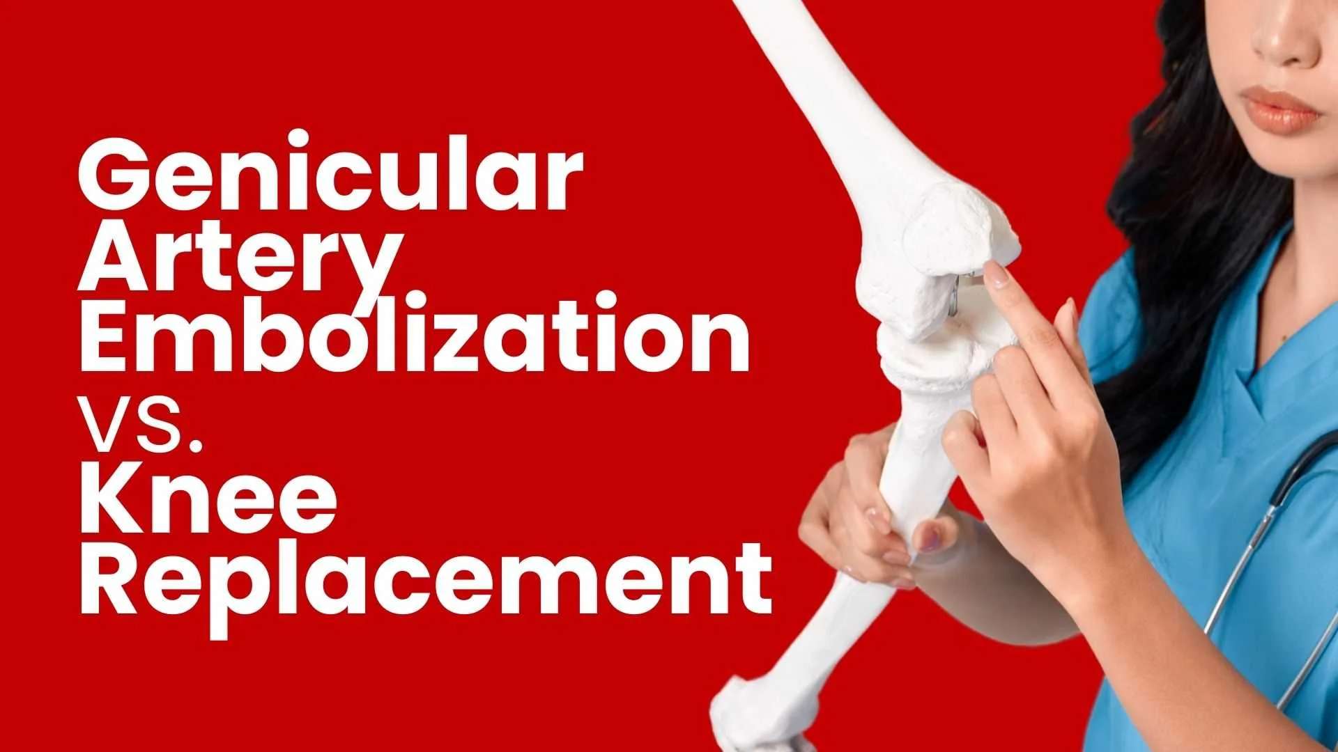 Genicular Artery Embolization